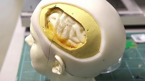 This flower-shaped electrode could make brain surgery less invasive and help epilepsy patients