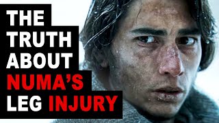 Numa Turcatti&#39;s Leg Injury Didn&#39;t Happen That Way | The Real Story | Society of the Snow