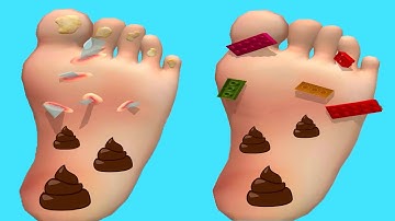 Foot Clinic - Gameplay Walkthrough - All Levels (IOS, Android)