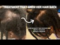 She applied this treatment twice a week and grew her hair back thicker  stronger hairloss