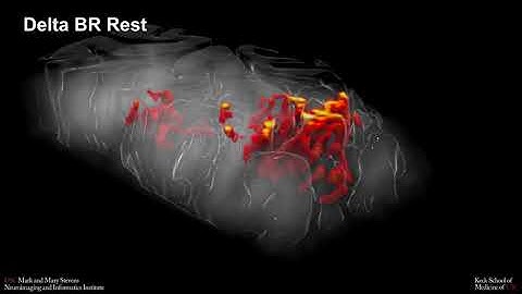 Perfusion fMRI of finger tapping (FT), brushing (BR) and rest at 7T