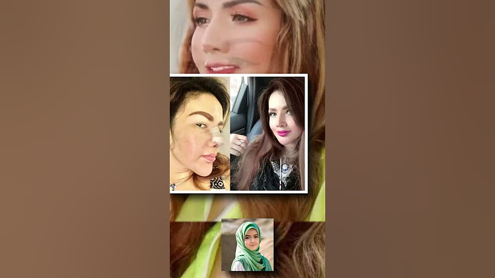 Barbie Kumalasari: Operasi Hidung dan Kelopak Mata Capai Ratusan Juta