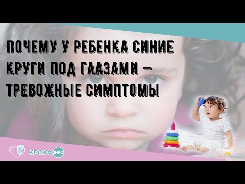 Почему у ребенка синие круги под глазами — тревожные симптомы