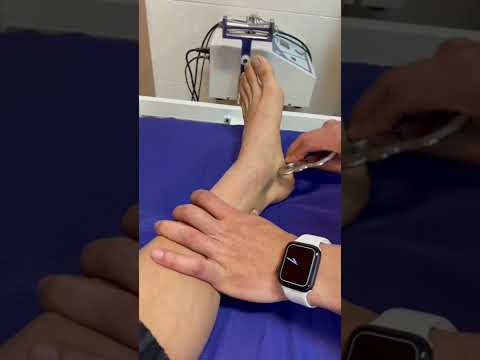 تصویری: نحوه درمان مچ پا متورم (همراه با تصاویر)