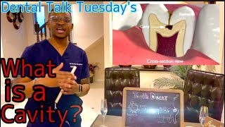 Dental Talk Tuesday's | Episode 3 What is a Cavity?