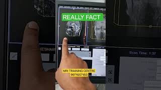 MRI REALLY PLANNING