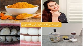 وصفات طبيعية سهلة و فعالة في تبييض الأسنان من الاستعمال الاول| Whiten Your Teeth INSTANTLY