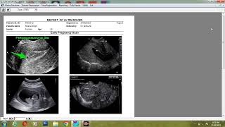 Ultrasound Reporting Software screenshot 4