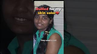 Secret Of My Skin Transformation