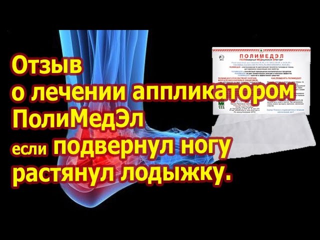 Сильно подвернул ногу? Опухла щиколотка? Растянул лодыжку? Аппликатор Полимедэл - отзыв о пленке.