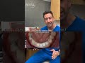 From Frustration to Confidence: How Technology Helped Transform This Smile