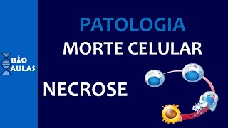 Necrose - Morte Celular: Coagulação, Liquefação, Caseosa, Gangrenosa, Gordurosa (Patologia Geral)