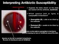 Disk Diffusion Test using Bacitracin or Optochin