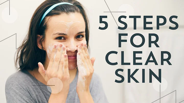 How I Cleared Up My Skin! 5 Steps | Ingrid Nilsen