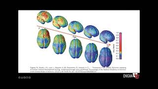 4 1 3 ENIGMAU Neurodevelopment3