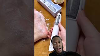 Those Feet Are Too Crusty