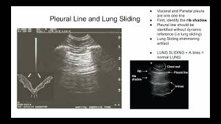 Introduction to Lung Ultrasound POCUS