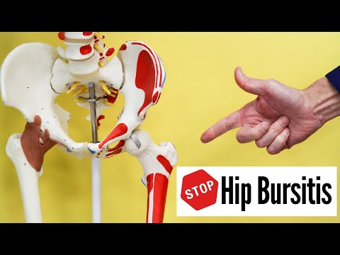 STOP Hip Bursitis Pain Without Seeing A Dr  or Having Injection