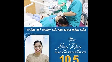 💎 NIỀNG RĂNG PHA LÊ 10,5TR/HÀM