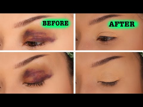 WELL THIS JUST HAPPENED.......HOW TO CORRECT A BLACK EYE/BRUISE WITH MAKEUP