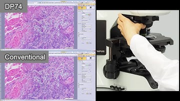 Olympus DP74 Microscope Camera - Auto Expose