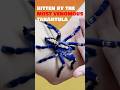 Bitten By The Most Venomous Tarantula The Gooty Sapphire Tarantula Venomous Spider Bitten By The Most Venomous Tarantula The Gooty Sapphire Tarantula Venomous Spider