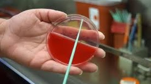 Pathology CPT codes Microbiology Part 1 - simplify medical coding