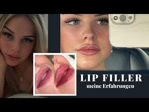 All about my lips- Kosten, Wo?, Wie viel ml?, Schmerzen