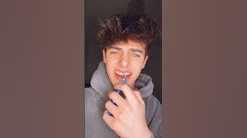 Kyle Thomas 💙 taking MY OWN braces off in 10 seconds 😳 #kylethomas #shorts