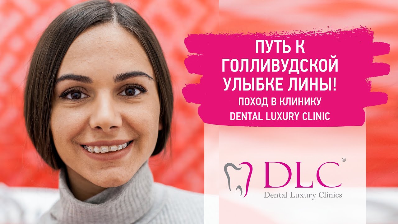 ЛИНА СТАВИТ БРЕКЕТЫ | Участница на пути к голливудской улыбке - YouTube