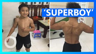 ‘Superboy’ Gets His Muscles From Rare Disorder