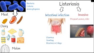 listeriosis - Symptoms and treatment.  Listeria monocytogenes.