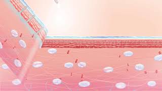 EPN - Electroporation Needle System
