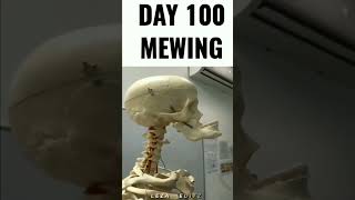 Day 100 Of Mewing - Edit - #Shorts #Memes #Funny