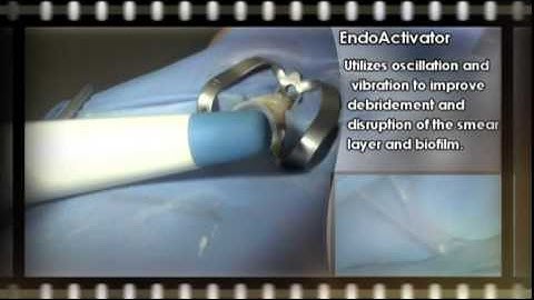 WaveOne Instructional Video