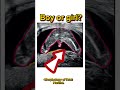 Gender reveal #boyvsgirl #shorts