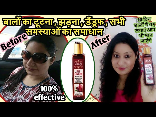 Vagads Khadi Herbal Gramodaya Red Onion Shampoo  Onion Hair Oil  210100ml  JioMart