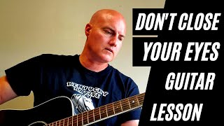 Don't Close Your Eyes by Keith Whitley Guitar Lesson Play Along: How to Play Country Guitar Classics