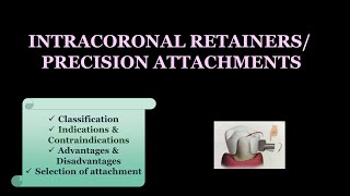 INTRACORONAL RETAINER / PRECISION ATTACHMENTS