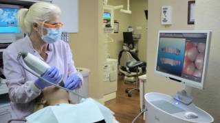 How Does Invisalign Work