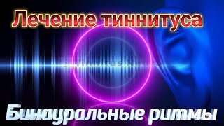 Лечение тиннитуса. Эффективное лечение звуковым эффектом от шума в ушах!