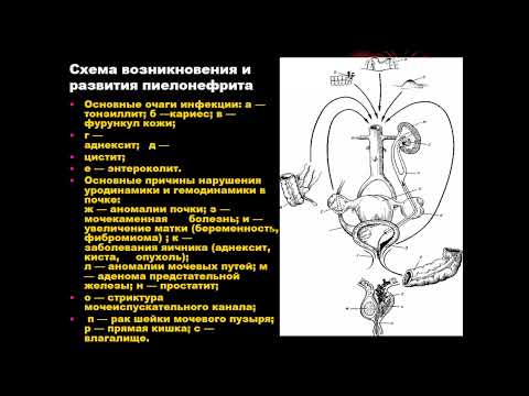 15:00-16:30 ВОСПАЛИТЕЛЬНЫЕ ЗАБОЛЕВАНИЯ МОЧЕПОЛОВЫХ ОРГАНОВ