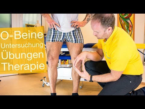 Video: Wie kann man O-Beine haben?