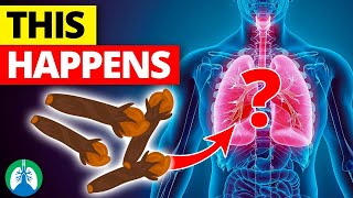 Take CLOVES for Your LUNGS and Watch What Happens