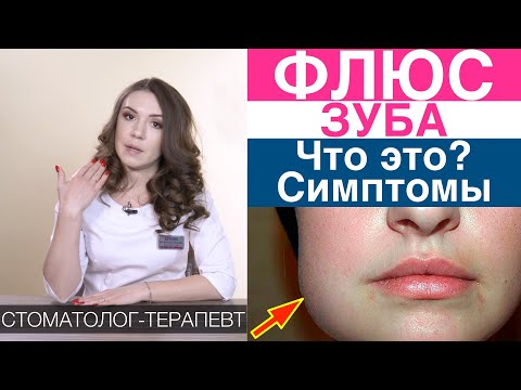 Флюс зуба -  что это, симптомы и диагностика флюса. Осложнения периодонтита