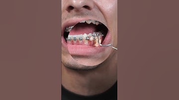 How YOU Are Brushing Your Teeth WRONG! 🚫🪥