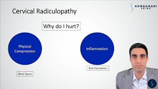Cervical Radiculopathy  Why do you hurt and what is the plan to get you better?