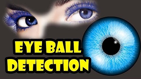 Eye Ball Detection in MATLAB [Teaser Video]