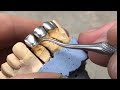 Изготовление фронтальных одиночных коронок с плечевой массой ЧАСТЬ 2. Зубной техник. Видео курс