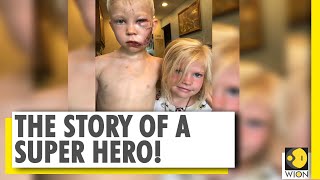 6-year-old boy fights with a dog to save his sister | Bridger Walker | US | World News | WION